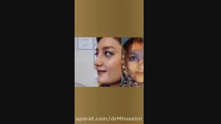 نمونه کار جراحی بینی دکتر حسینی در اهواز