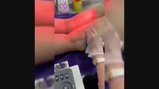 یکی از روش های درمان واریس پا