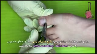 آموزش کاشت ناخن پا : مرحله اول : زیر سازی - نیل آکادمی