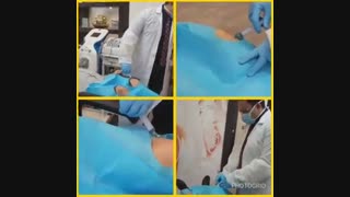 یک روز پر از ارتروز