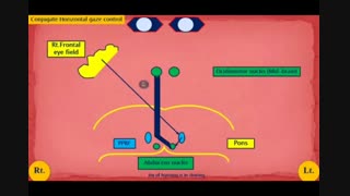 سندروم یک و نیم