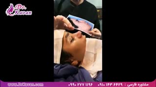 عمل بینی گوشتی