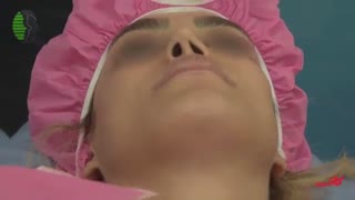 روش ابداعی دکتر باستانی نژاد در جراحی بینی کوتاه