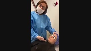 فیلم از بین بردن کک و مک صورت اصلاح فرم صورت