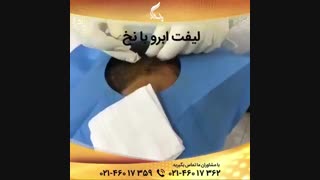 لیفت ابرو با نخ
