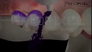 آموزش بهداشت دهان و دندان