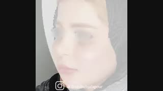 فیلم تزریق چربی به صورت برداشتن خال