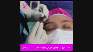 فیلم کاشت ابرو | کلینیک رز | 09104440228 | شماره 210
