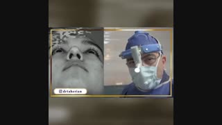 فیلم جراحی زیبایی بینی