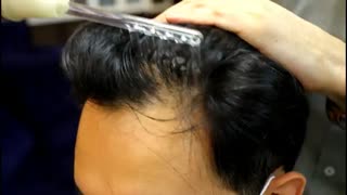 درمان قطعی ریزش مو بروش هیدرودرمی09126074167