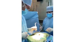 جراحی رزکسیون استخوان دنبالچه