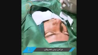 فیلم جراحی بینی در اتاق عمل
