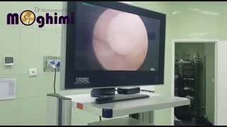 فیلم عمل جراحی آرتروسکوپی زانو و بازسازی رباط صلیبی