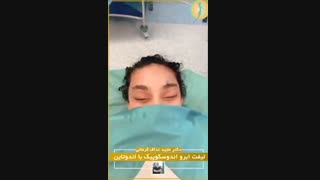 فیلم لیفت اندوسکوپیک ابرو با اندوتاین
