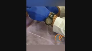 تزریق یک و نیم سی سی ژل خط خنده