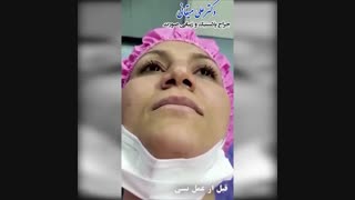 فیلم ترمیم بینی