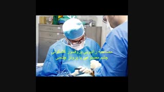 مصاحبه رادیویی پروفسور کشکولی درباره چشم مصنوعی