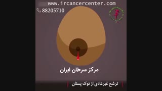 12 نشانه برای تشخیص سرطان سینه