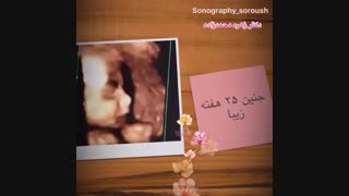 جنین 25 هفته