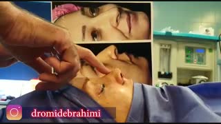 عمل بینی استخوانی قوز دار توسط دکتر امید ابراهیمی بهترین جراح بینی استخوانی در تهران