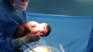 فیلم زایمان سزارین