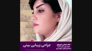 جراحی زیبایی بینی در کرج