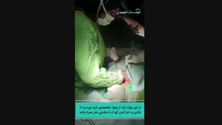 زایمان سزارین دکتر شهناز احمدی