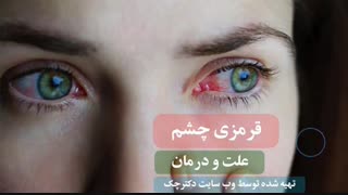 دلایل شایع قرمزی چشم و بهترین روش درمان آن