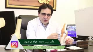 ساختمان زانو