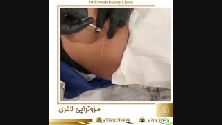 فیلم چگونه در 2 ماه لاغر شویم؟