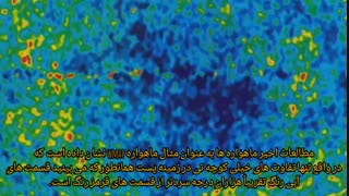 پروژه ترجمه زیرنویس استاد صدیقه وحدت لیفت پیشانی