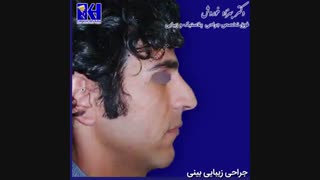 نمونه کار جراحی زیبایی بینی
