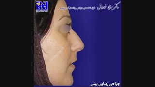 فیلم جراحی زیبایی بینی