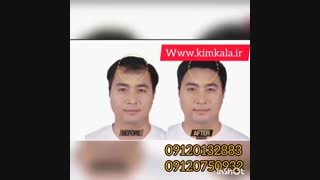 اسپری پر پشت کننده مو/09120750932/پرپشت کننده مو
