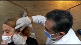 بهترین پزشک طب سوزنی  | 02122853829