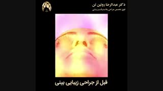 جراحی زیبایی بینی | فوق تخصص جراحی پلاستیک و زیبایی | دکتر عبدالرضا روئین تن