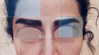 کاشت ابرو به چه صورت است؟