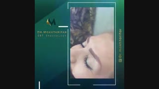 فیلم تزریق بوتاکس