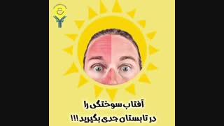 درمان آفتاب سوختگی در تابستان