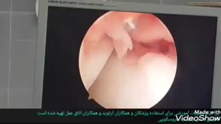 فیلم آموزشی جهت رزیدنتهای ارتوپدی