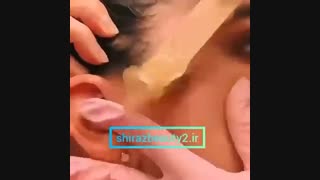 اپیلاسیون صورت با صمغ عربی لیفت ابرو