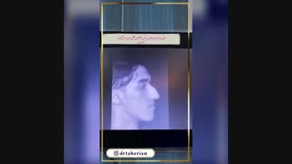 فیلم جراحی زیبایی و درمانی بینی