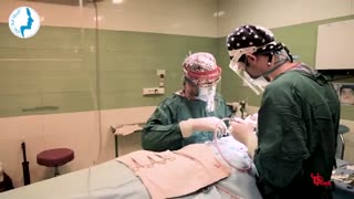 جراحی زیبایی بینی با قوس ملایم توسط دکتر گلی