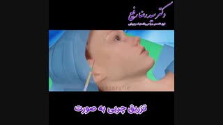 انیمیشن تزریق چربی | دکتر رضا رفیع