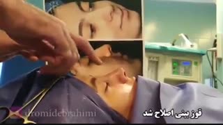 عمل بینی استخوانی | دکتر امید ابراهیمی لیپوساکشن