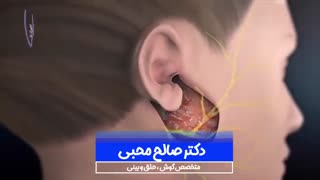فیلم جراحی تومور و عصب صورت