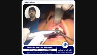 دکتر علیرضا پورنبی-Drpournabi (@dr.pournabi_omfs) • Instagram photos and videos_2