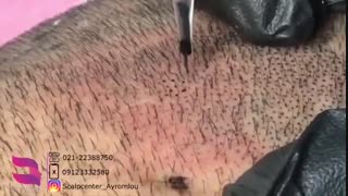 اسکالپ اسپرت چیست؟