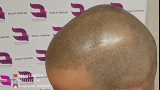 اسکالپ اسپرت مناسب چه افرادی است؟