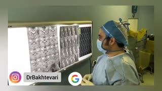 جراحی دیسک گردن